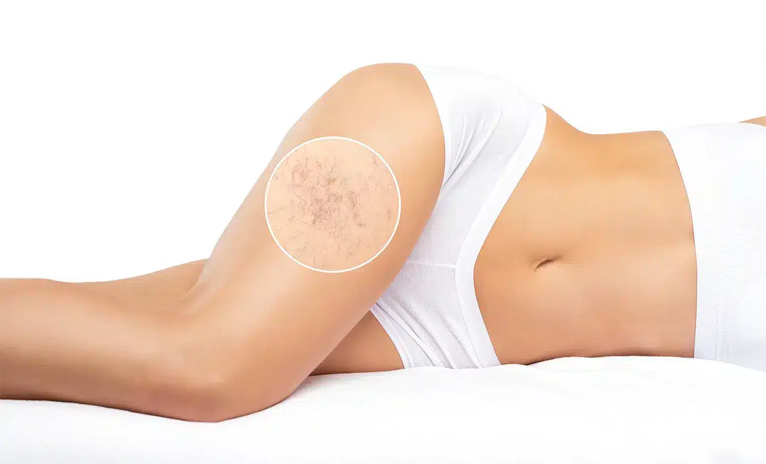 Image de l'option produit