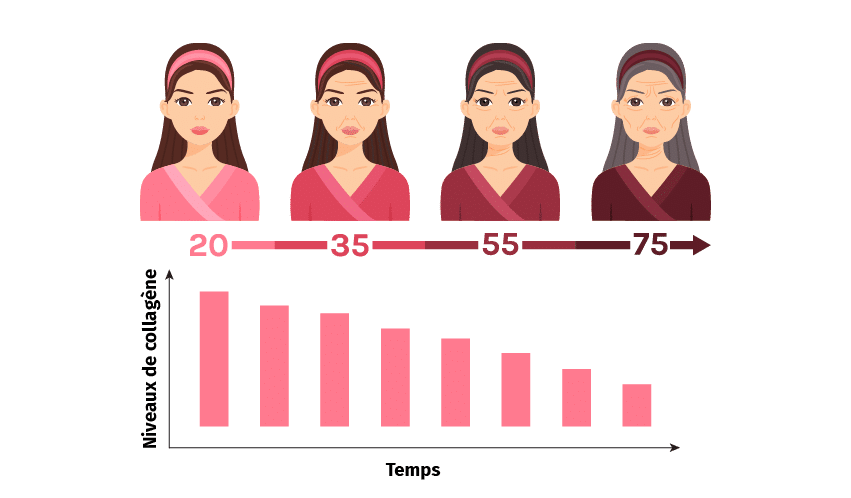 Image de l'option produit