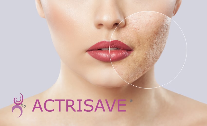 Image de l'option produit