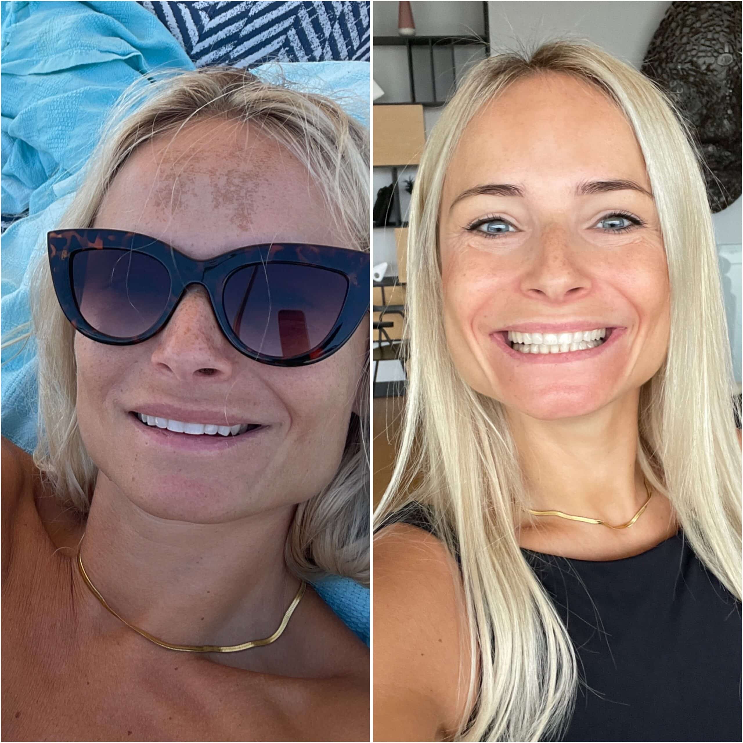 Image de l'option produit